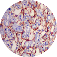 imunohistoquimica