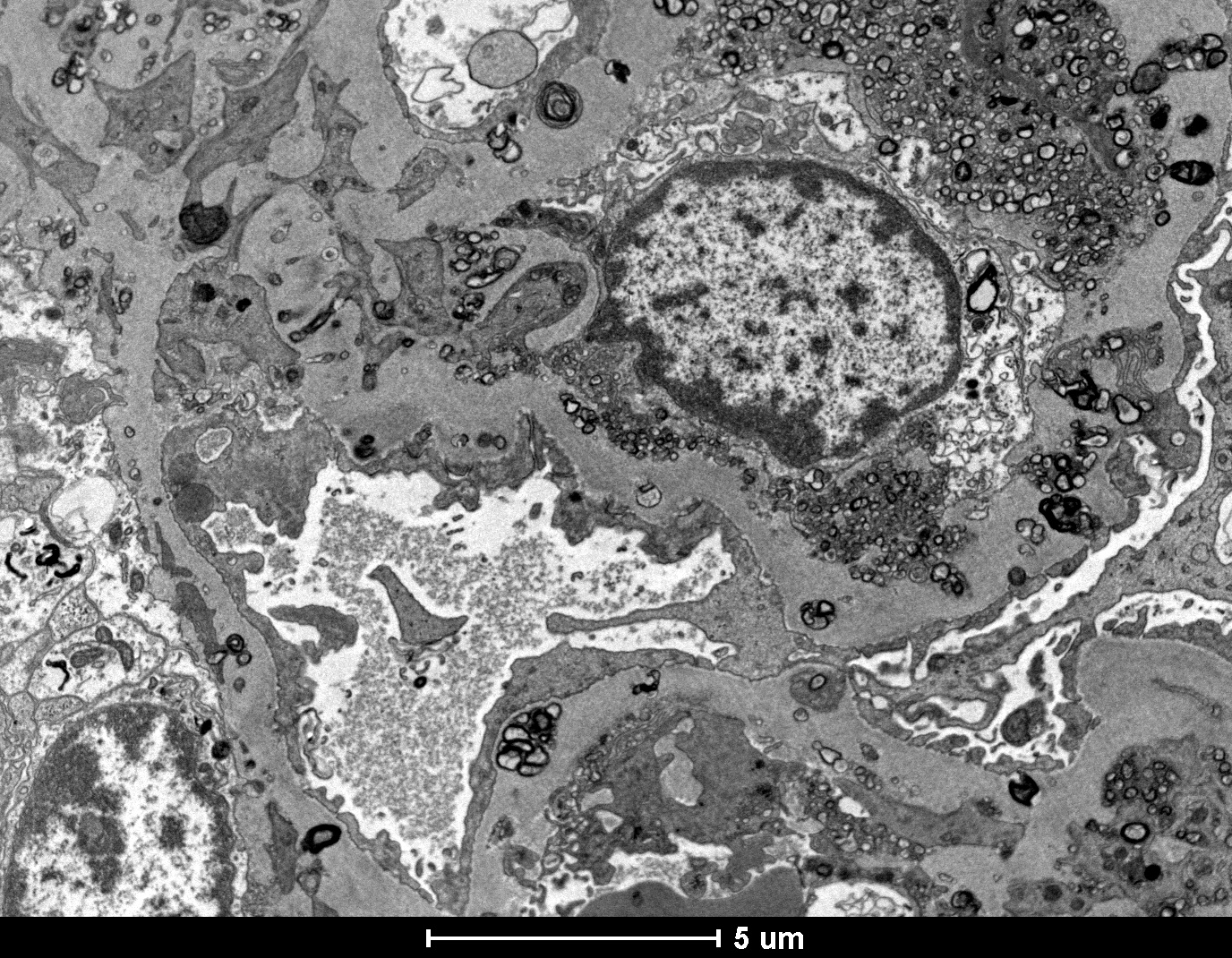 Imagem do microscopia Eletronica