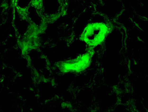 Imagem do fluorescencia
